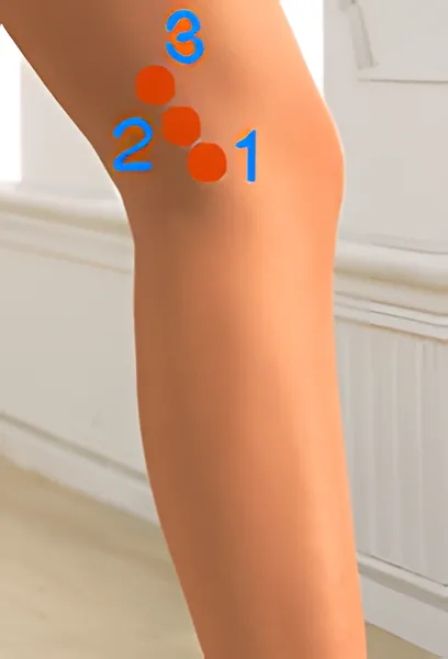Sơ đồ huyệt Âm Ủy 3