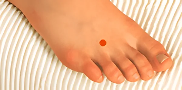 Sơ đồ huyệt Bàng Cốc