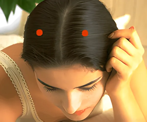 Sơ đồ huyệt Chính Dinh