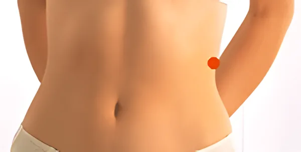 Sơ đồ huyệt Chương Môn