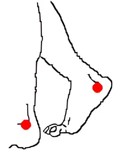 Sơ đồ huyệt Cung Trì