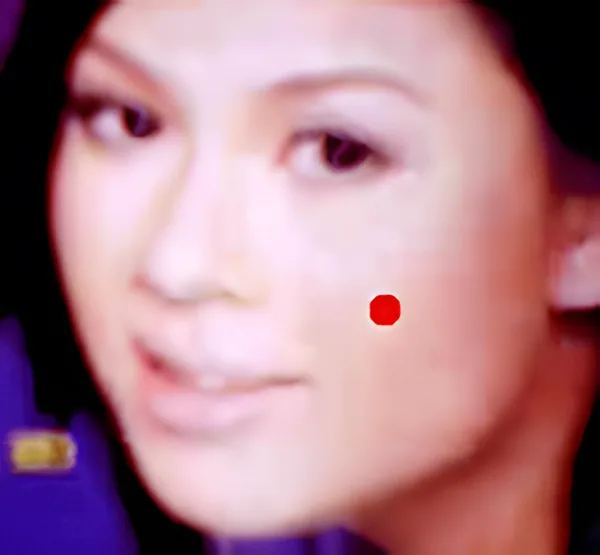 Sơ đồ huyệt Diện Nham