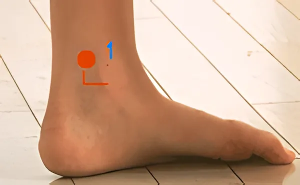 Sơ đồ huyệt Dục Đoạn Sản