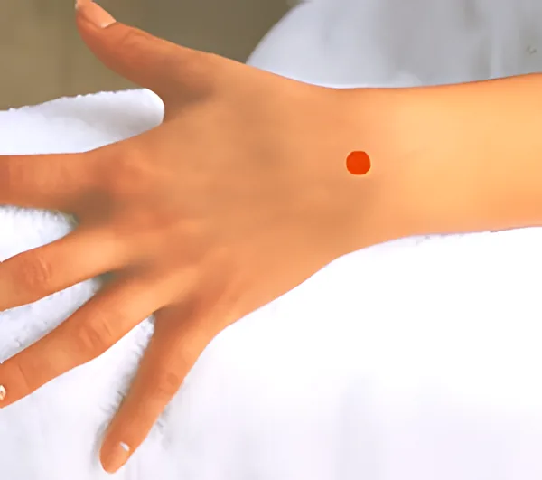 Sơ đồ huyệt Dương Trì