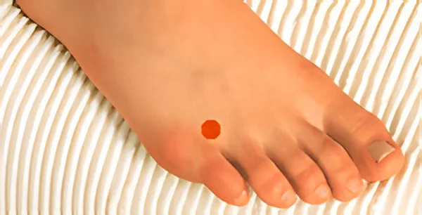 Sơ đồ huyệt Địa Ngũ Hội