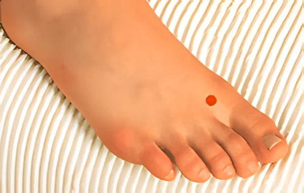 Sơ đồ huyệt Hành Gian