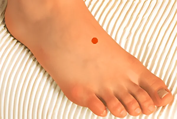 Sơ đồ huyệt Hậu Thái Xung
