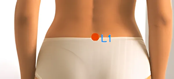 Sơ đồ huyệt Huyền Khu