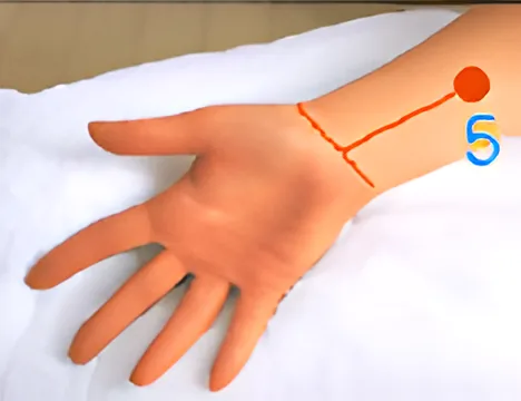Sơ đồ huyệt Khích Môn