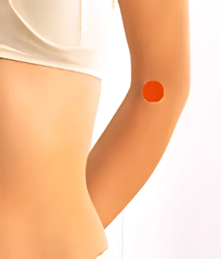Sơ đồ huyệt Khúc Trạch