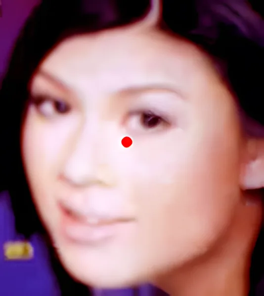 Sơ đồ huyệt Kiến Minh