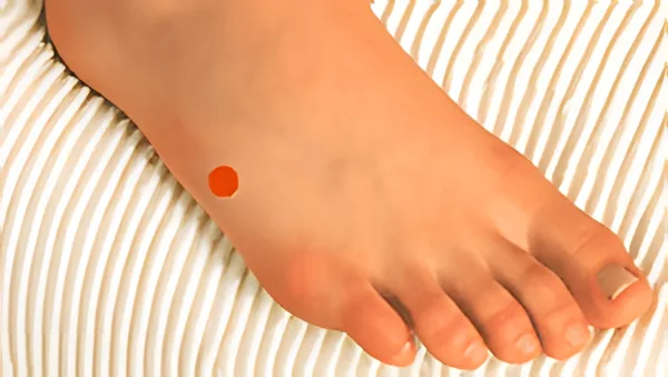 Sơ đồ huyệt Kinh Cốt