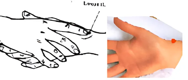 Sơ đồ huyệt Liệt Khuyết