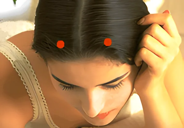 Sơ đồ huyệt Mục Song