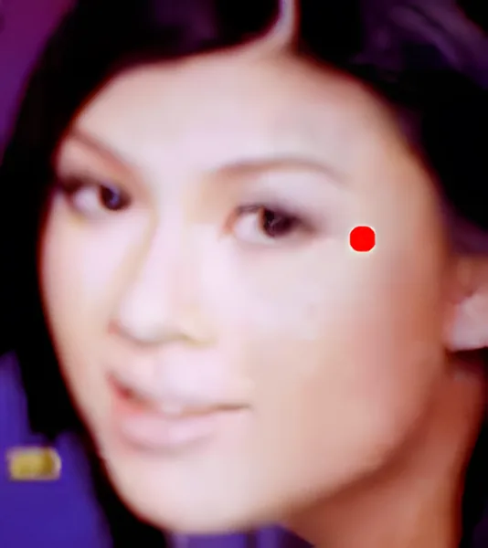 Sơ đồ huyệt Ngư Vĩ