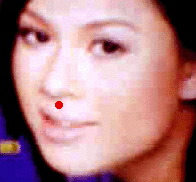 Sơ đồ huyệt Nhân Trung