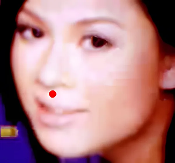 Sơ đồ huyệt Nhân Trung