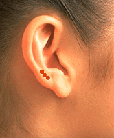 Sơ đồ huyệt Nhĩ Bình Ngoại Tam Huyệt