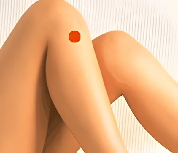 Sơ đồ huyệt Nhị Lý Bán