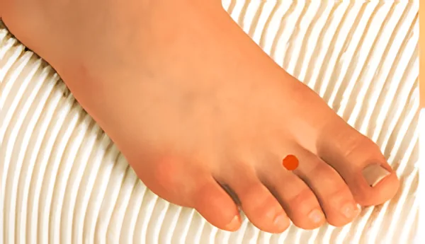 Sơ đồ huyệt Nội Đình