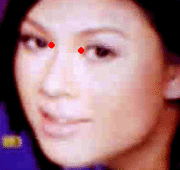 Sơ đồ huyệt Nội Minh
