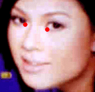Sơ đồ huyệt Nội Tinh Minh