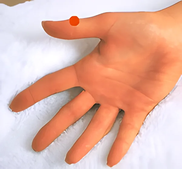 Sơ đồ huyệt Phượng Nhãn