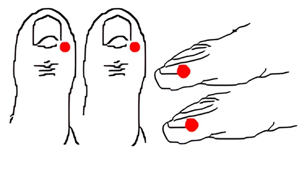 Sơ đồ huyệt Quỷ Khốc