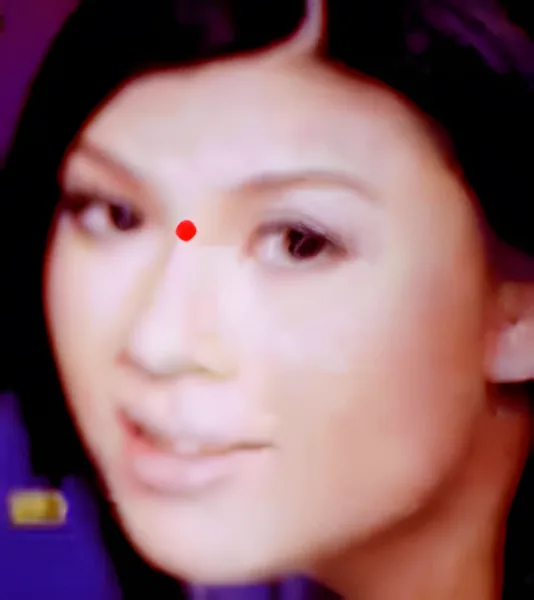 Sơ đồ huyệt Sơn Căn