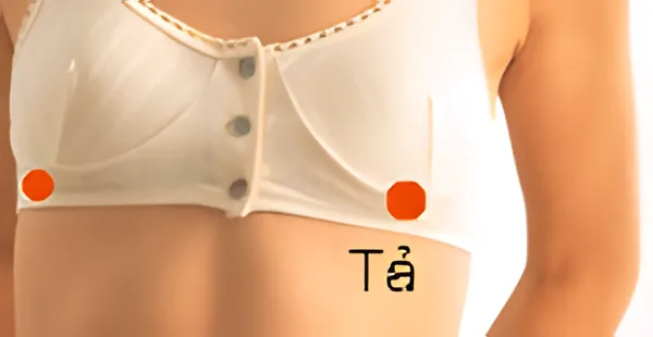 Sơ đồ huyệt Tả Nghi