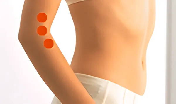 Sơ đồ huyệt Tam Trì