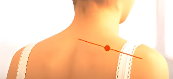 Sơ đồ huyệt Thiên Liêu