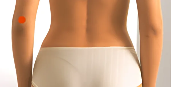 Sơ đồ huyệt Thiên Tỉnh