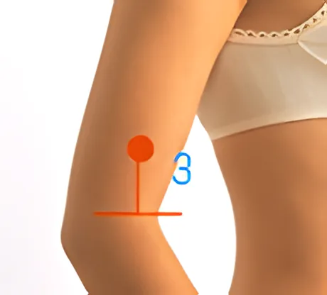 Sơ đồ huyệt Thủ Ngũ Lý