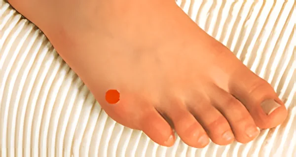 Sơ đồ huyệt Thúc Cốt