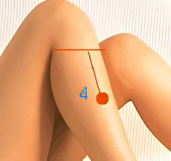Sơ đồ huyệt Thượng Cự Hư