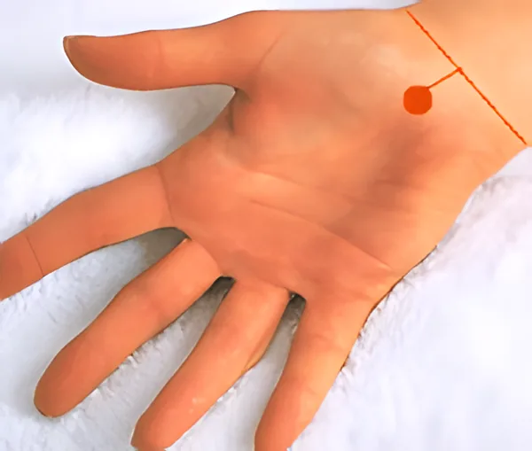 Sơ đồ huyệt Tiểu Thiên Tâm