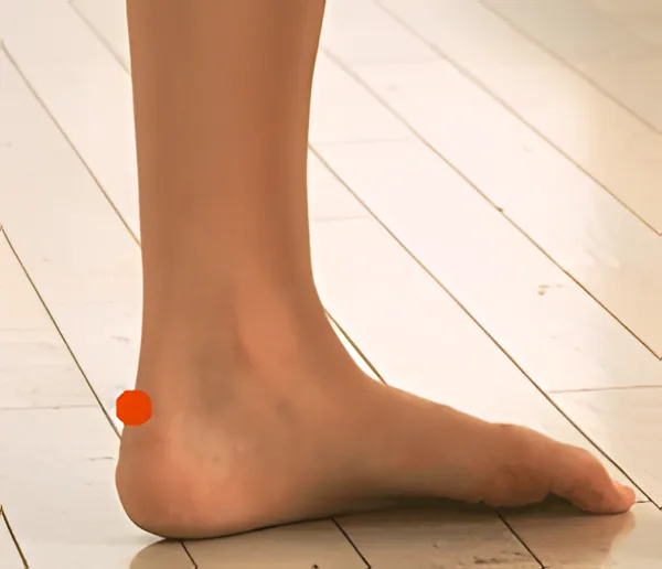 Sơ đồ huyệt Tuyền Sinh Túc