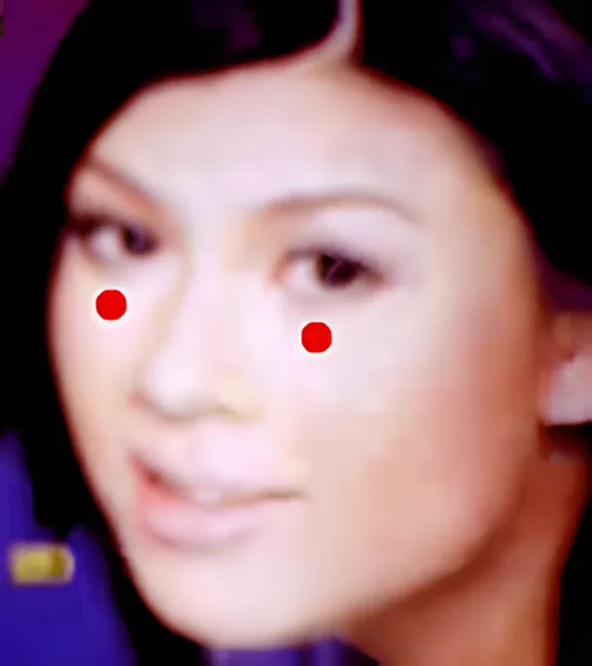 Sơ đồ huyệt Tứ Bạch
